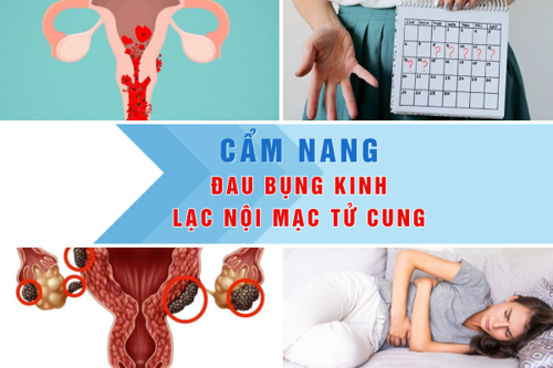 Cẩm nang dành cho người bị đau bụng kinh, lạc nội mạc tử cung